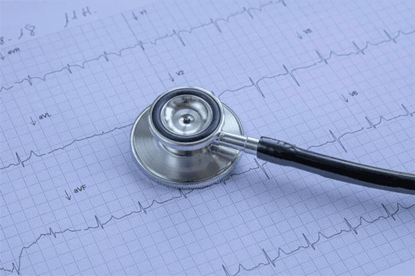 ¿Qué es un electrocardiograma y como se aplica en enfermería?