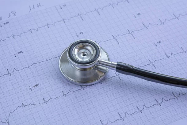 Patrones de ECG que sugieren una estenosis u oclusión de la arteria coronaria crítica de alto riesgo